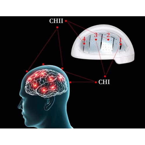 hospital clínica cerebro luz modulada auriculares infrarrojos casco láser casco