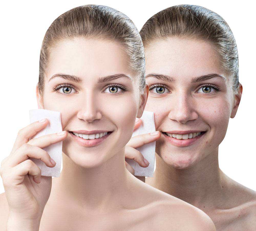 hyaluronic acid 
