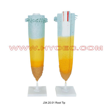 Root Tip-J34.20.01
