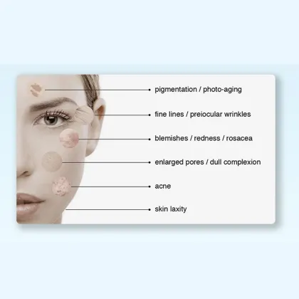 pdt led light therapy beauty machine