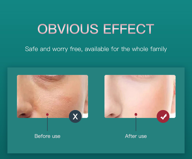 Red Light Therapy for Face LED Light Therapy2(14)