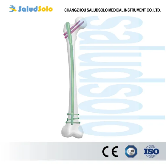 Femoral shaft fractures Intramedullary nail
