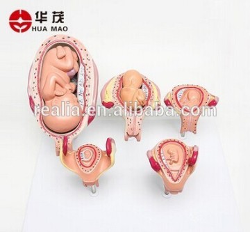 HM-BD-169 Fetus development model Embryonic development model Fetal development model 5parts