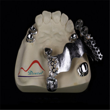 Tahan lama teleskopik Dental Crown