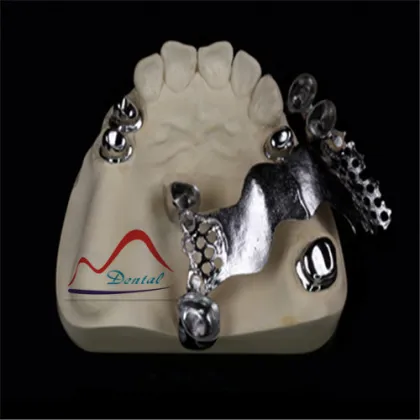 Dental Nice Looking Telescopic Crown