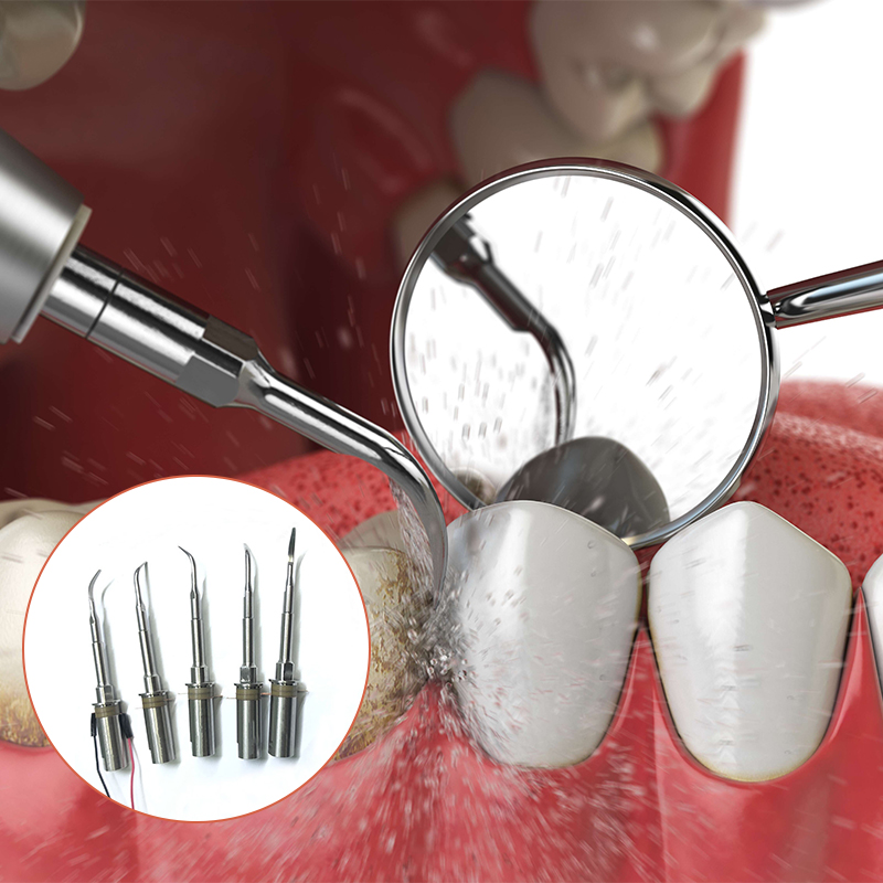 Ultrasonic tooth cleaning tool 