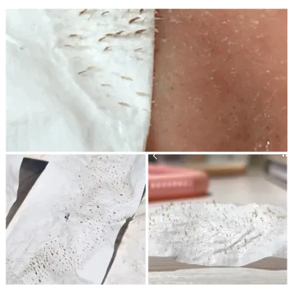 BREYLEE Blackhead Mask - Blackhead Facial Masks by Breylee