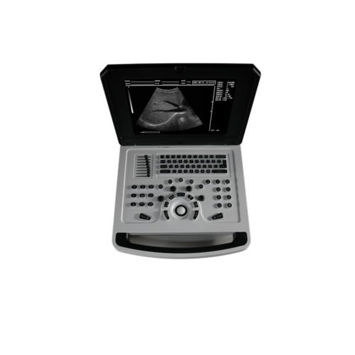 Cheap Notebook Black and White Ultrasound Scanner