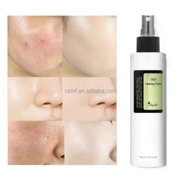 Customized Logo Niacinamide Hydrating Toner for Acne and Dark Spots
