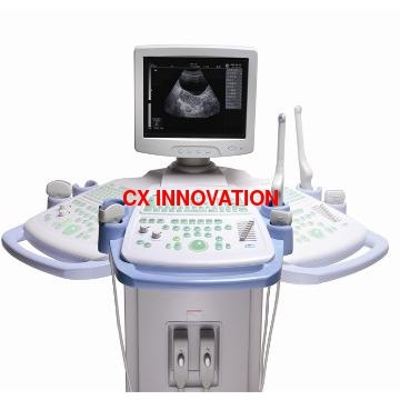 digital ultrasound scanner B mode