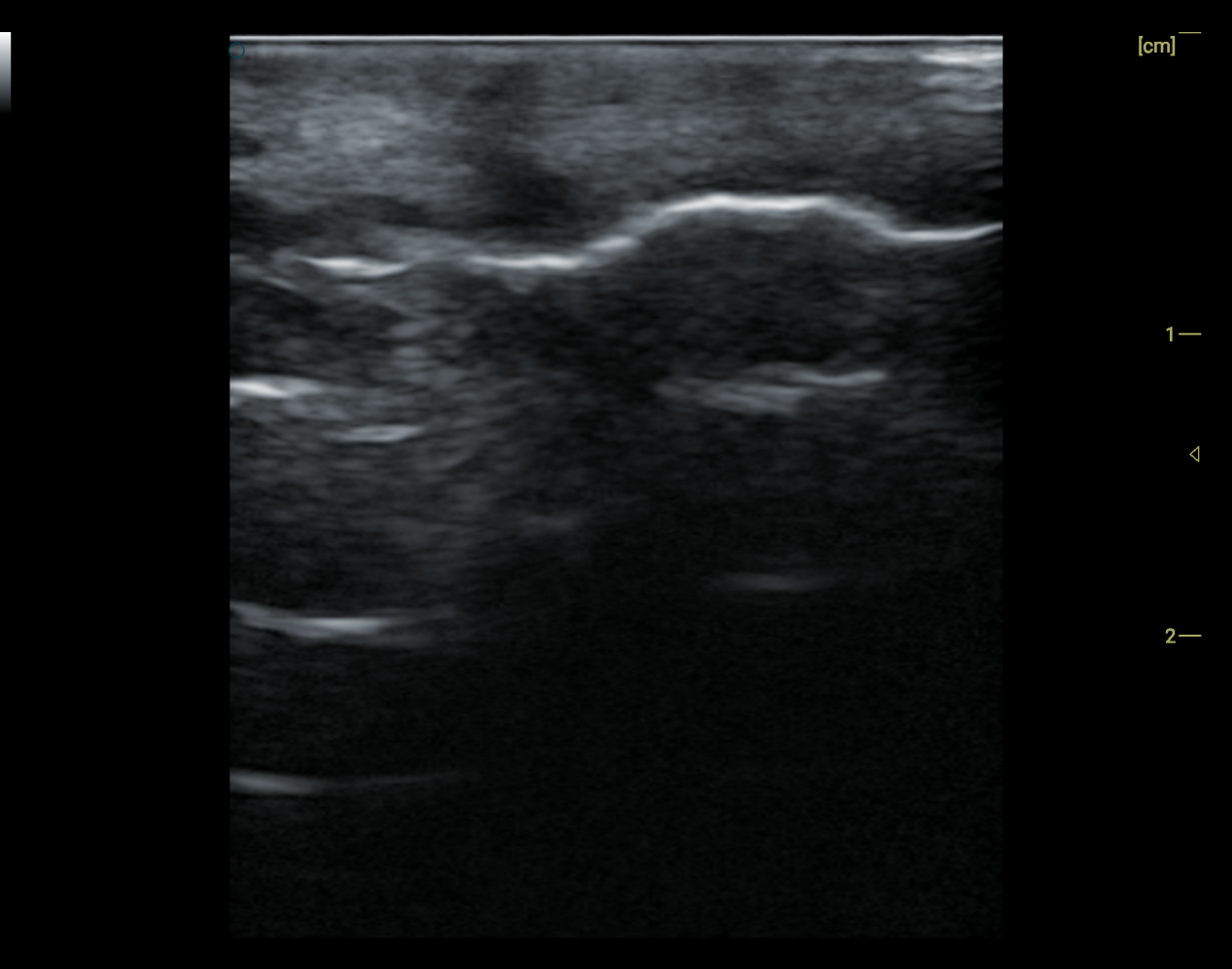 High-Frequency Handheld Ultrasound Probe – al