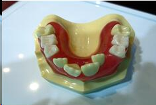 Deciduous Teeth
