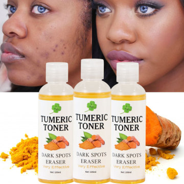 Wholesale Private Label Water-Based Moisturizer for Dark Spots Correction