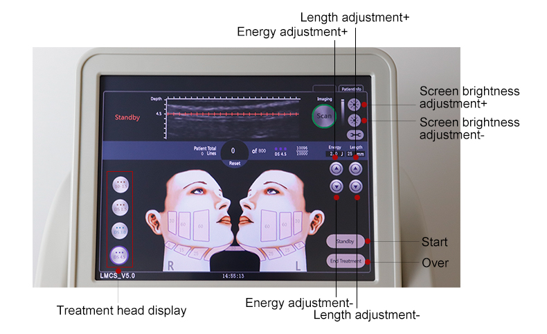 mini hifu machine