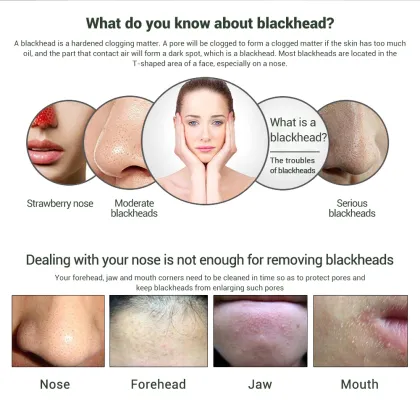 Biqian facial mask light