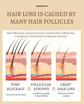 Factory Wholesale Natural Organic Ginger Polygonum Multiflorum Hair Shampoo - 650ml