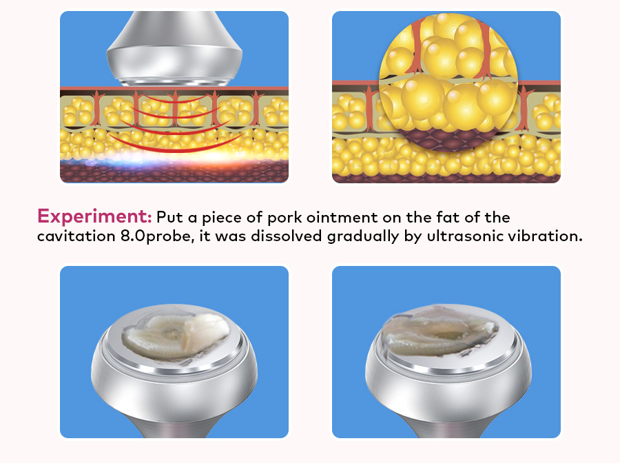 fat reduction therapy
