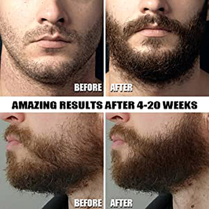 Set de 9 piezas mejor kit de afeitar de barba