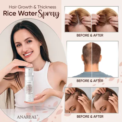 New  Herbal Rice Water Smoothing Hair Loss Hair Nourishing Spray with Rich Water