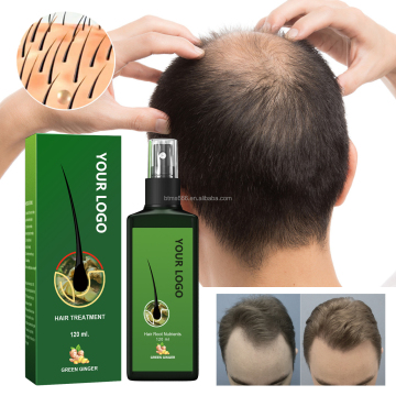 Bettermiss Private Label Human Hair Regrowth Treatment Essential Oils Care Spray