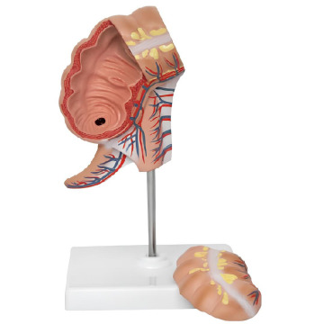 آپاندیس و آناتومی Cecum