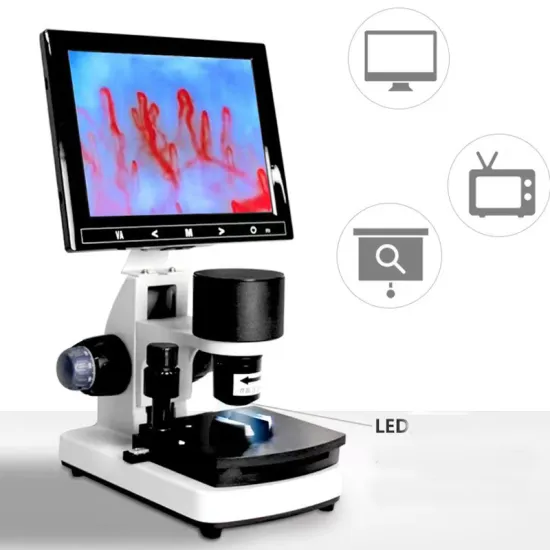 Portable Nailfold Video Capillaroscopy Microscope for Microcirculation Analysis