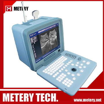 Medical Ultrasound Diagnosis System MT300V series