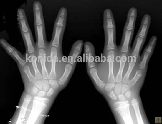 high quality medical dry film thermal film for complete scanning system