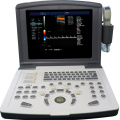 Portable Color Doppler Ultrasound Machine for Cardiac