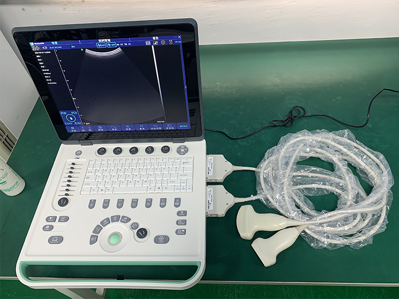 Color doppler ultrasound portable labtop type