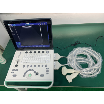 Color doppler ultrasound medical equipment labtop portable