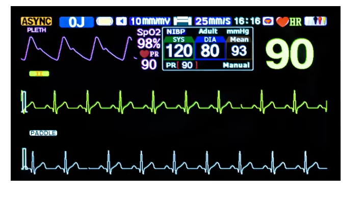 Defi-monitor/biphasic