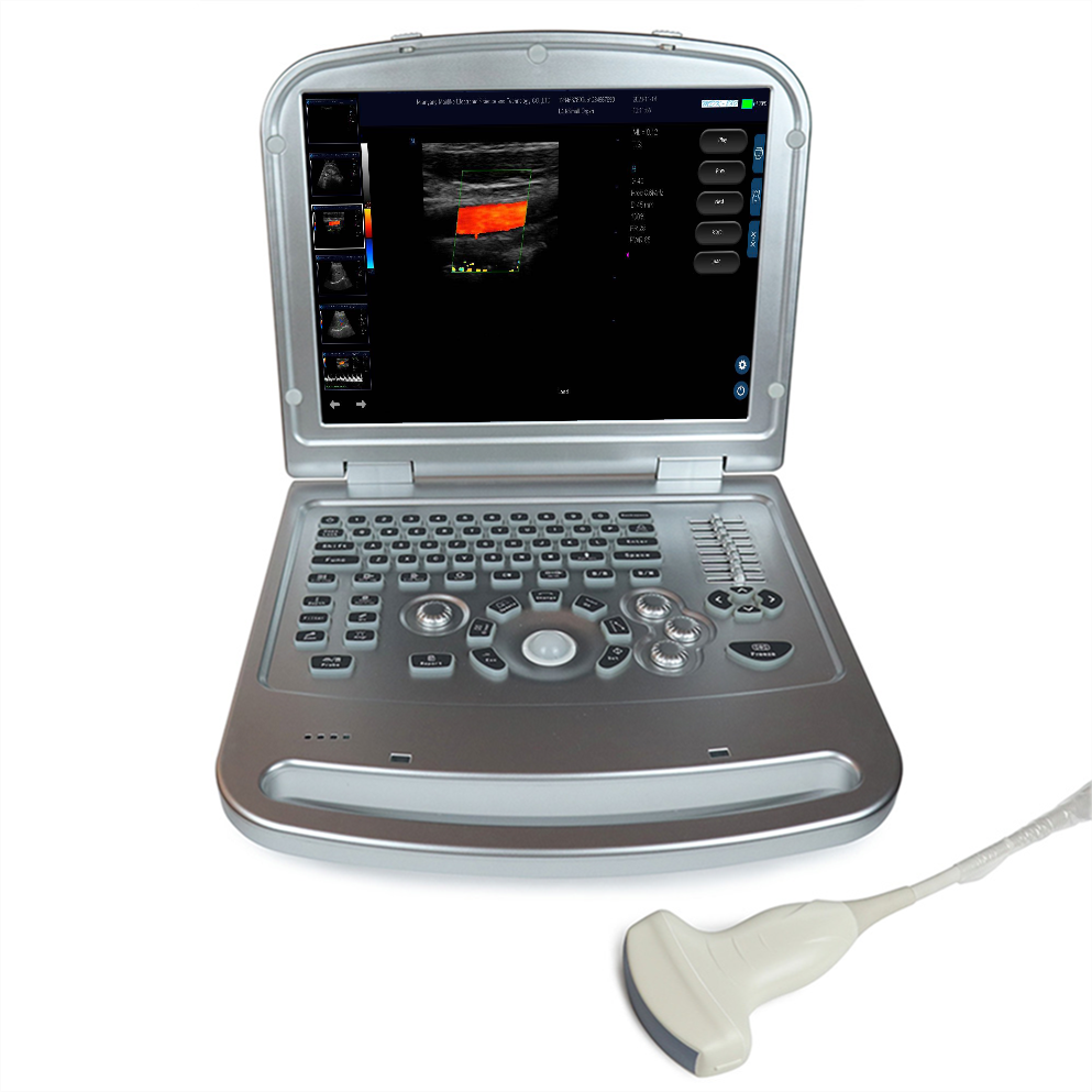 Full Digital Color Doppler Laptop Ultraschallmaschine