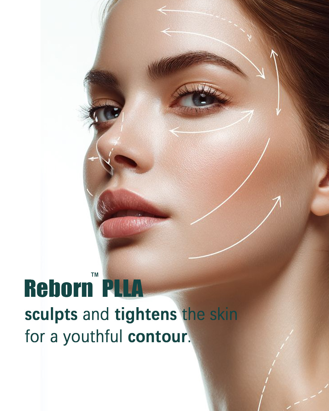 Reborn PLLA Sculpts and Tightens the Skin