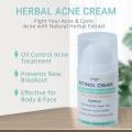 Crema per cicatrici da acne Pimpli Dark Spot Remover