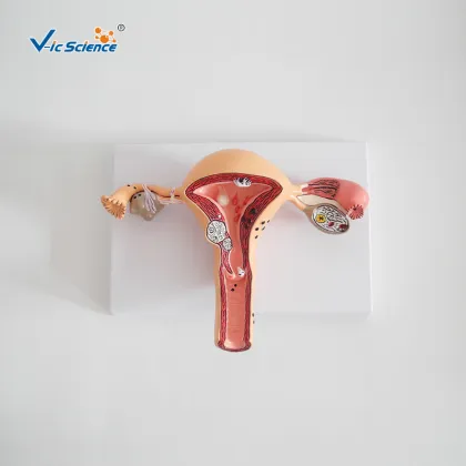 Pathological Uterine Anatomy Education Model