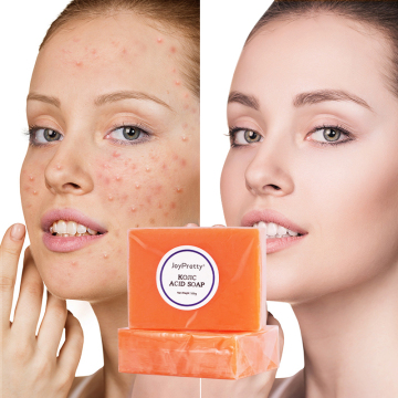 Hot Selling Handmade Kojic Acid Soap - Private Label Organic Skin Whitening Solution