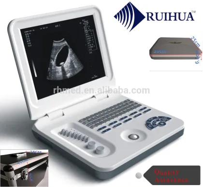 Cheapest USG Factory Price Ultrasonogram Ultrasound Machine