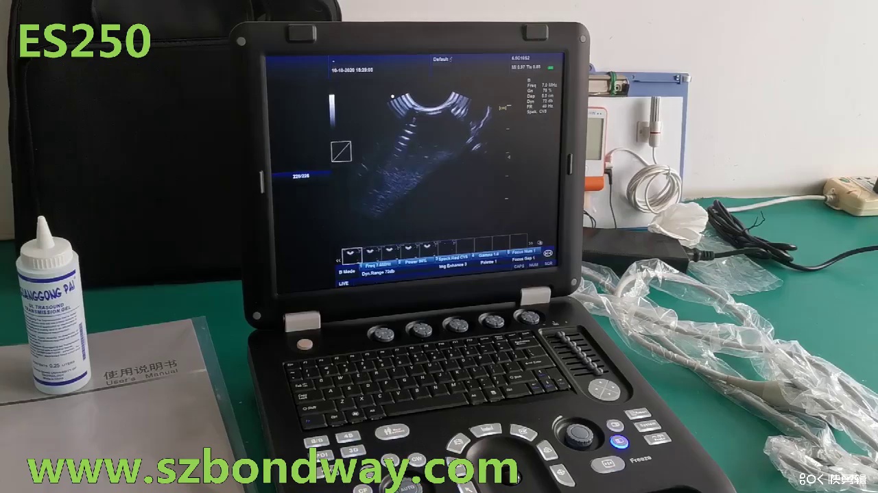 Veterinary Sonography System Es250V