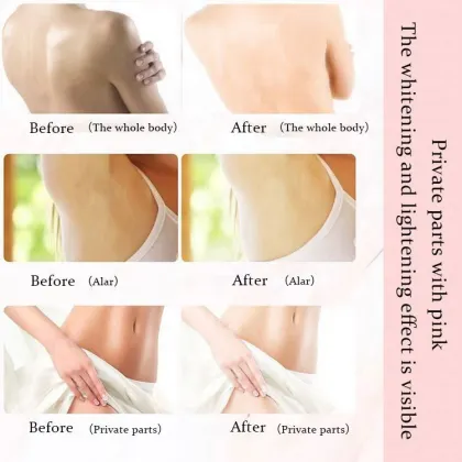 Intimate Whitening Cream Vagina Dark Spot Whitening Lotion Whitening Bleaching Cream