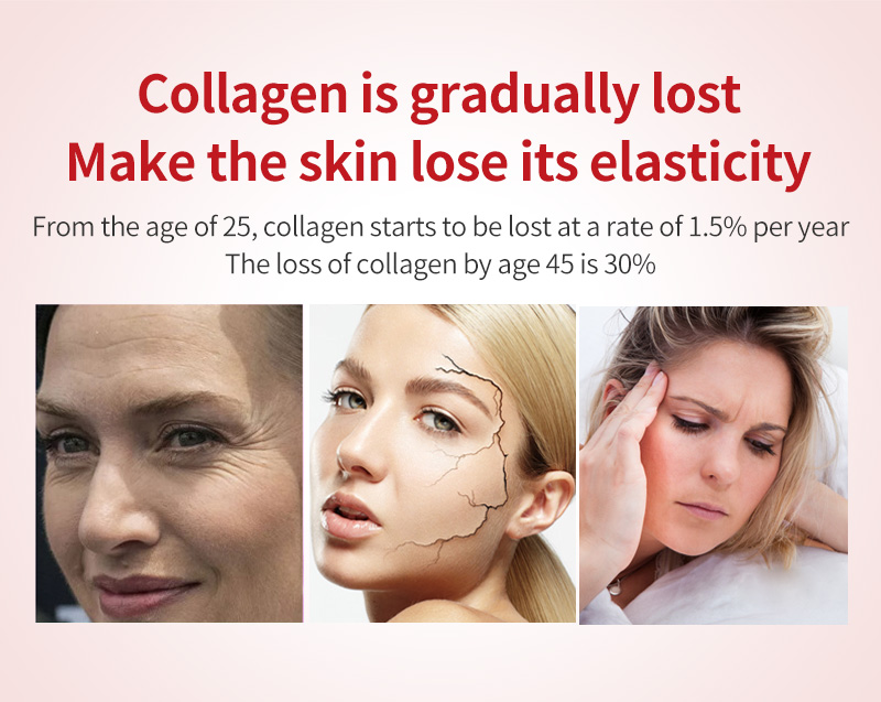 OEM/ODM Collagen Oral Liquid Hyaluronic Acid Nicotinamide Collagen Peptide Collagen Oral Liquid