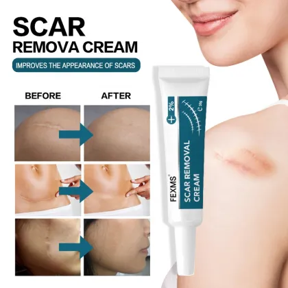 FEXMS Scar Removal Cream - 30g: Reduces Redness and Thickness, Improves Scar Appearance with Safe Ingredients