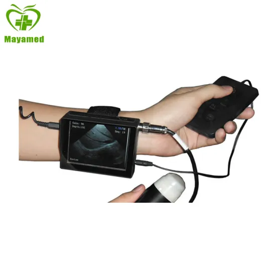 Portable Veterinary Wrist Ultrasound Sector Sweep Scanning Mode