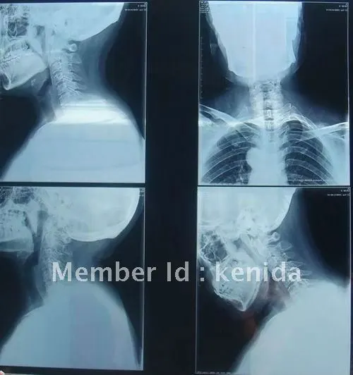 sony film ct system kodak xray film