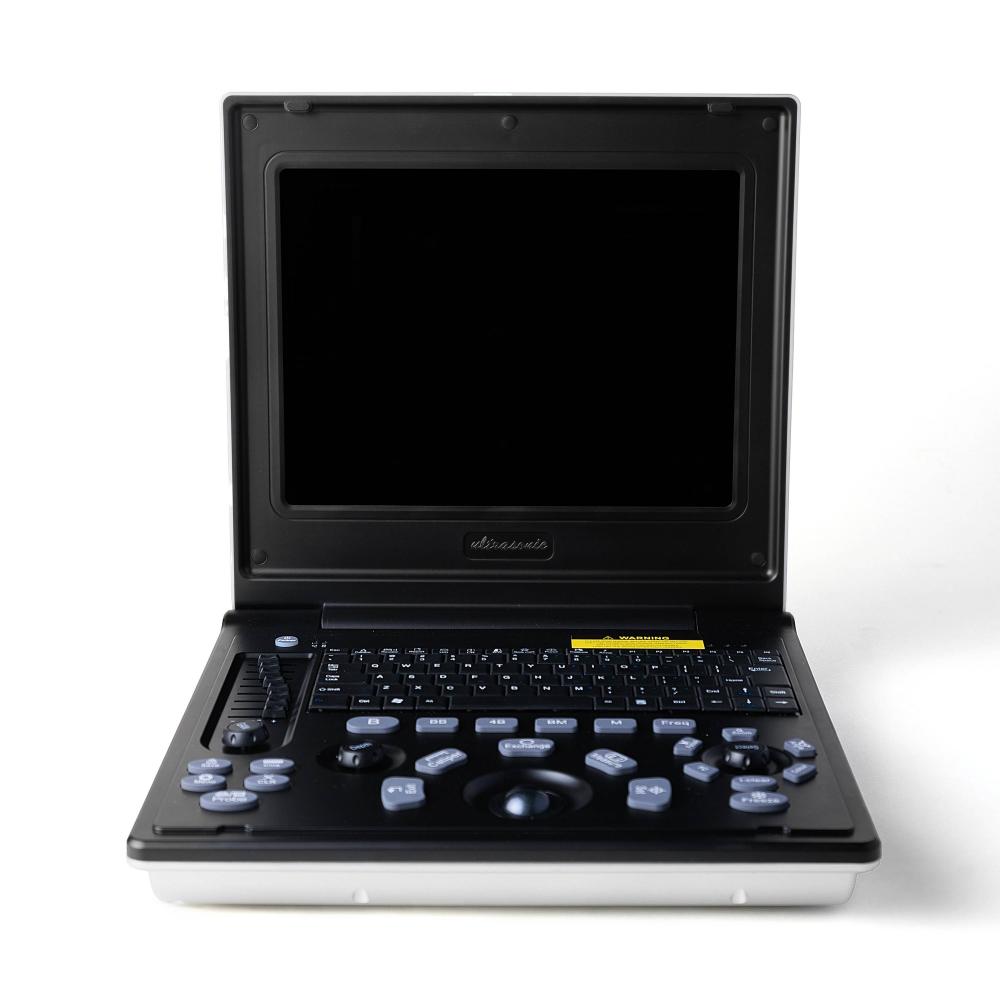 Ультрагукавое даследаванне ноўтбука для перырэнальнага разрыву ў Мэн Котках