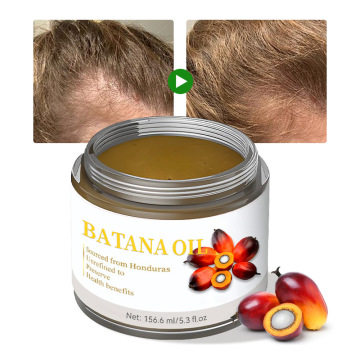 Großhandel Private Label Organic Batana Haarwachstumsprodukte