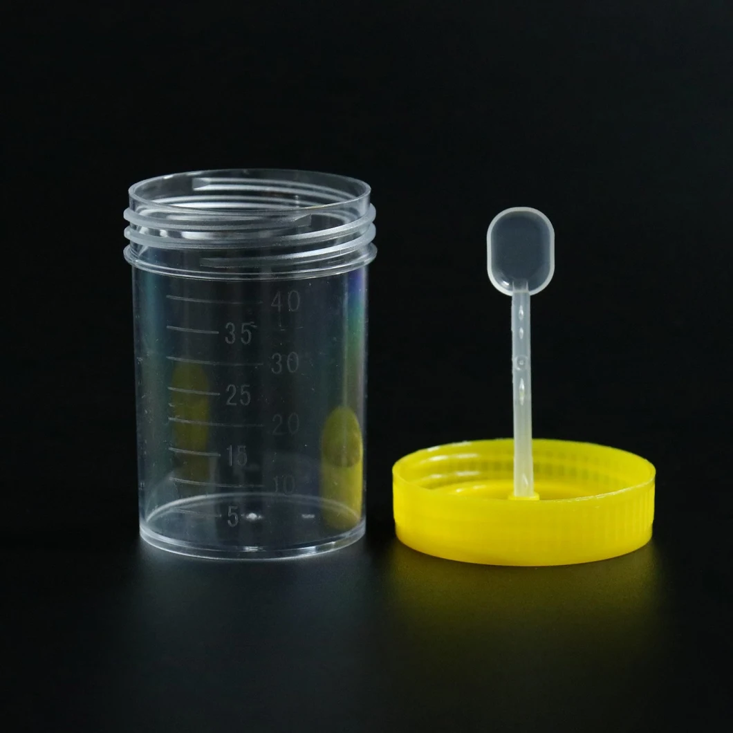 Siny alta calidad 70 ml 80 ml de plástico estéril hospital de suministro de heces médicas contenedor de muestras
