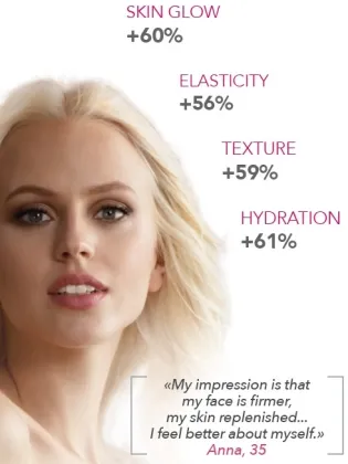 Teosyal Redensity 2 Puresense (2X1ml) Teoxane Under Eye Circle Fighter Filler