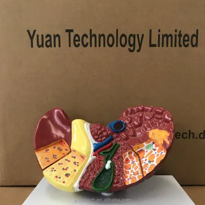 Nature Sized Human Diseased Liver Cancer Structure Model