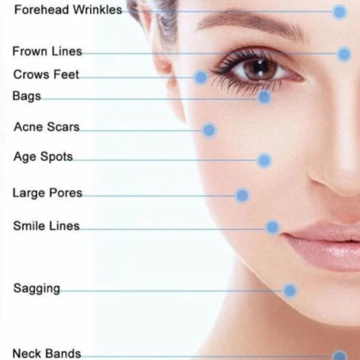 Cirurgia plástica facial antes e depois